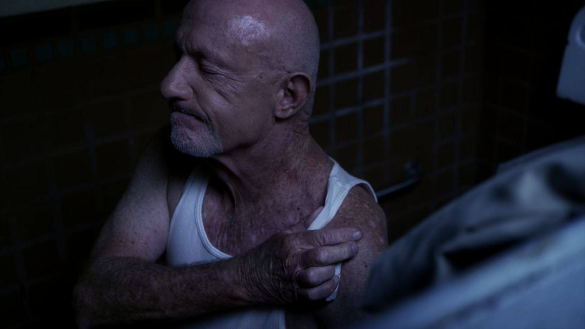 Mike covers his wounds from the night before